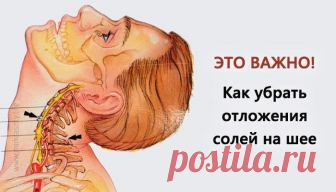 Избавляемся от отложения солей на шее / Все для женщины