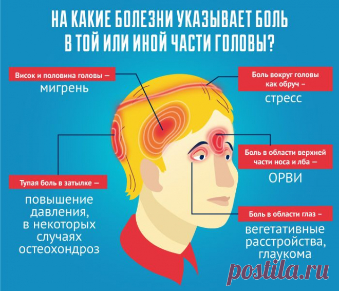 Давление, мигрень или... стресс? О каких болезнях расскажет головная боль | Здоровая жизнь | Здоровье | Аргументы и Факты