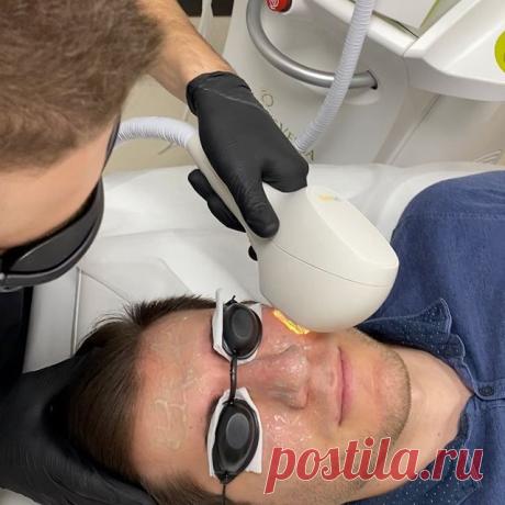 Vascular manifestations⤵️
⠀
Photorejuvenation successfully copes with vascular manifestations.
Skin cells contain a protein called HEMOGLOBIN.
It is responsible for delivering oxygen to cells🔁
When the capillary vessel expands, hemoglobin stagnates in it.
Such congestion appears on the skin in the form of spider veins. If the asterisk is located deep enough, then it shines through the skin with a blue tint, and if it is close to the skin surface, then red.
With photorejuv...