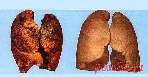 НАРОДНЫЙ РЕЦЕПТ ДЛЯ ОЧИЩЕНИЯ ЛЕГКИХ КУРИЛЬЩИКА. 

Для того чтобы приготовить этот очищающий лёгкие травяной сбор Вам потребуются следующие ингредиенты: солодка (корневище), трава донника, тимьян, фенхель, душистая фиалка, корень девясила, листья подорожника, молодые свежие сосновые почки и первоцвет. Итак, для приготовления возьмите любые семь трав из вышеперечисленного списка, измельчите их и смешайте в равных количествах.
Показать полностью…