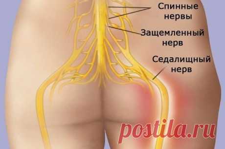 КАК РАЗБЛОКИРОВАТЬ СЕДАЛИЩНЫЙ НЕРВ
Как разблокировать седалищный нерв: 2 простых способа снять боль
Седалищный нерв свое начало берет в поясничном отделе позвоночника и, проходя через ягодицы, тянется к ступне. Поэтому боль при его защемлении чувствуется особенно сильно. 
Как правило, термин «защемление/ущемление седалищного нерва» подразумевает потерю эластичности и гибкости мышц задней поверхности ноги. Это часто связано с процессом возрастного укорочения (ригидности) мы...