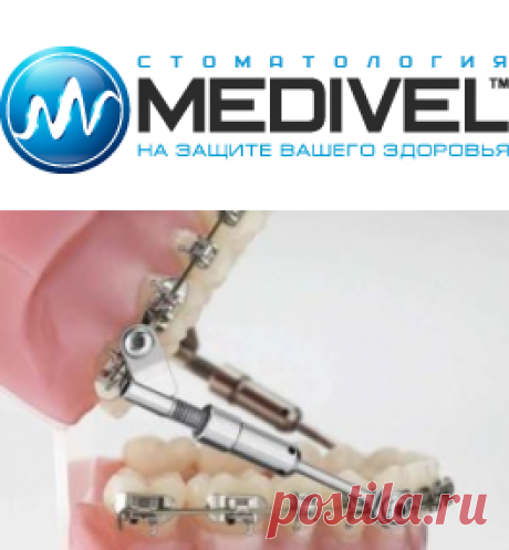 Ортодонтия в круглосуточном стоматологии "Medivel" | MEDIVEL
