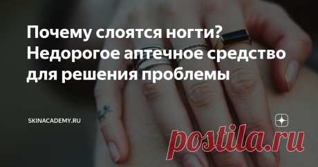 Почему слоятся ногти? Недорогое аптечное средство для решения проблемы