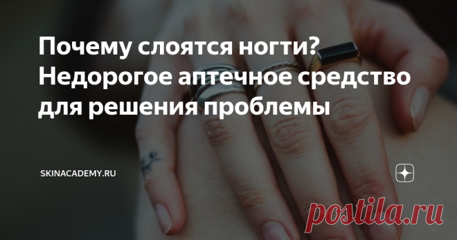 Почему слоятся ногти? Недорогое аптечное средство для решения проблемы
