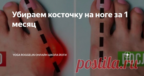 Убираем косточку на ноге за 1 месяц Статья автора «Yoga Roggelin онлайн школа йоги» в Дзене ✍: Проблема выпирающей косточки у большого пальца ноги — это боль многих женщин.