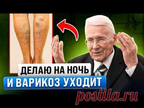 Невероятно! Это убийца варикоза! Стирает варикоз как Ластик (рецепт Болотова)