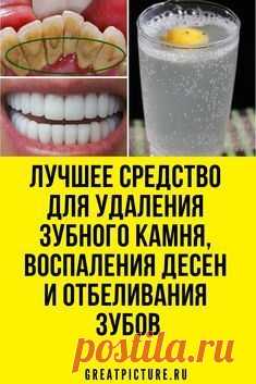 Лучшее средство для удаления зубного камня,и отбеливания зубов! Следим за зубами