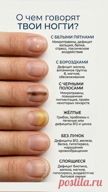 О чем говорят ваши ногти: зеркало внутреннего состояния организма