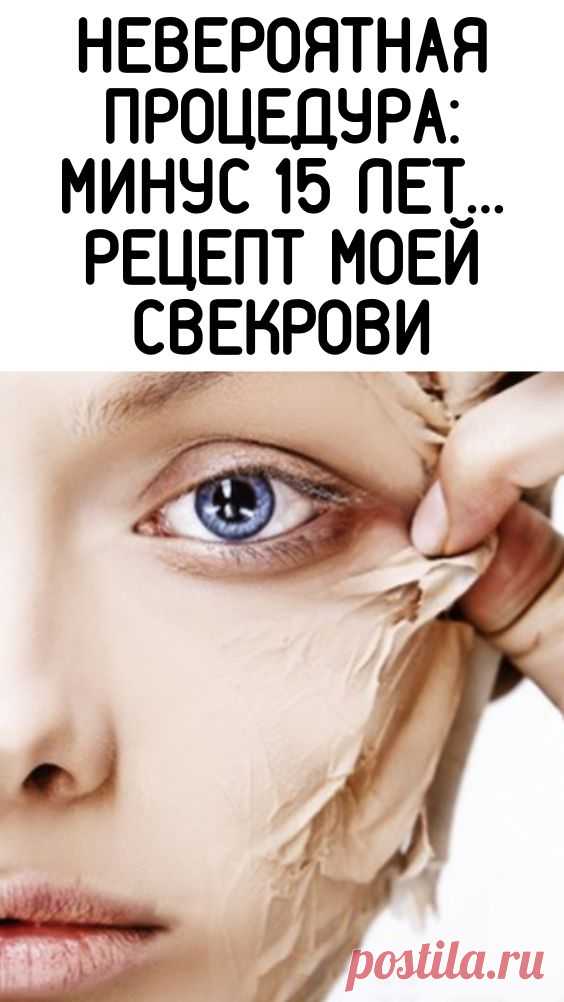 (1) Pinterest