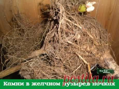 Камни в желчном пузыре,в почках. 
Хочу поделиться некоторыми рецептами, которые я испытал на себе в борьбе за свое здоровье. 
Лет пять назад меня увезли на «скорой» в больницу с приступом колик в печени. При обследовании выяснилось, что в желчном пузыре три камня: 1,2 см, 1 см и 0,8 см. Хотели резать, но я отказался и стал лечиться домашними способами. 
Вначале пил урину по 3-5 глотков 3 раза в день. Затем узнал рецепт с корнем подсолнуха и стал пить его настой. Проверился...