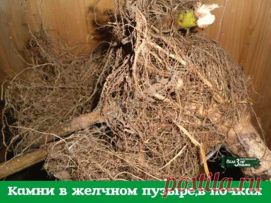 Камни в желчном пузыре,в почках. 
Хочу поделиться некоторыми рецептами, которые я испытал на себе в борьбе за свое здоровье. 
Лет пять назад меня увезли на «скорой» в больницу с приступом колик в печени. При обследовании выяснилось, что в желчном пузыре три камня: 1,2 см, 1 см и 0,8 см. Хотели резать, но я отказался и стал лечиться домашними способами. 
Вначале пил урину по 3-5 глотков 3 раза в день. Затем узнал рецепт с корнем подсолнуха и стал пить его настой. Проверился...