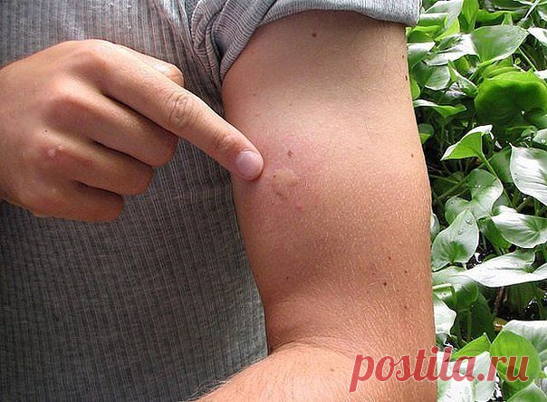 цитата Belenaya : Доступно -от комаров! (21:52 02-06-2015) [5285951/363528846] - ver-gap@mail.ru - Почта Mail.Ru