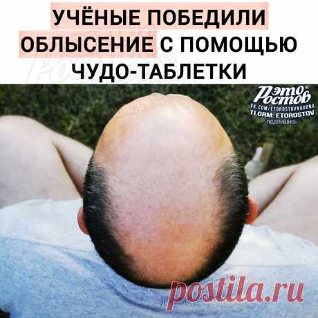 🦲 Облысение — В С Ё: учёным удалось победить.. | Это Ростов! Новости | ВКонтакте