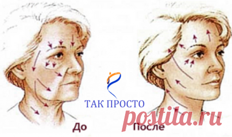 (57) Одноклассники