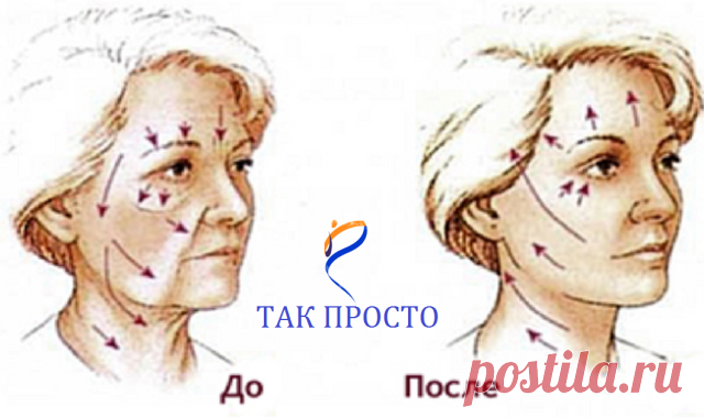 (57) Одноклассники