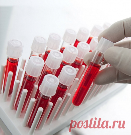 10 анализов, которые стоит сдать, если не получается похудеть | Диеты со всего света