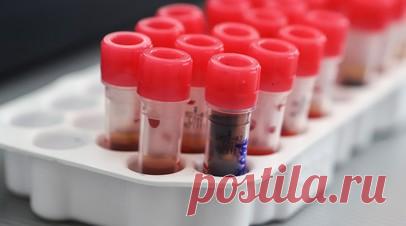 Более тысячи тюменцев включили в регистр доноров костного мозга в 2025 году. В Тюмени 3,5 тыс. человек внесли в регистр доноров костного мозга и гемопоэтических стволовых клеток с 2022 года. Из них 1018 человек решили стать донорами в 2025 году. Читать далее