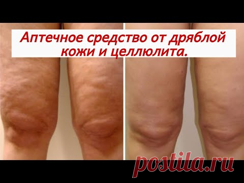 Подтяжка кожи своими руками: целлюлит, растяжки и дряблая кожа. Недорогое аптечное средство.
