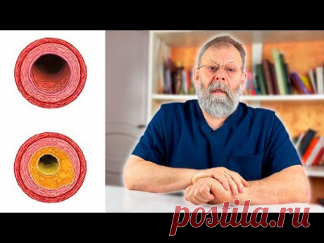 3 упражнения для идеальных сосудов