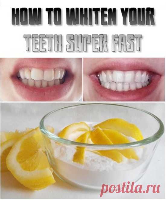 15 способов применения пищевой соды Вы не знали раньше | Postris