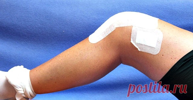 Уникальное средство для ленивых. Когда боль в суставах замучила, помогут эти 3 компонента