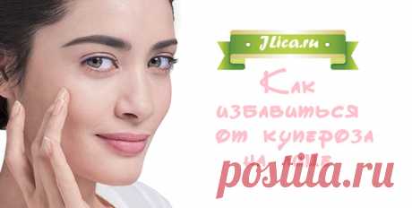 Купероз на лице: причины, способы лечения и отзывы