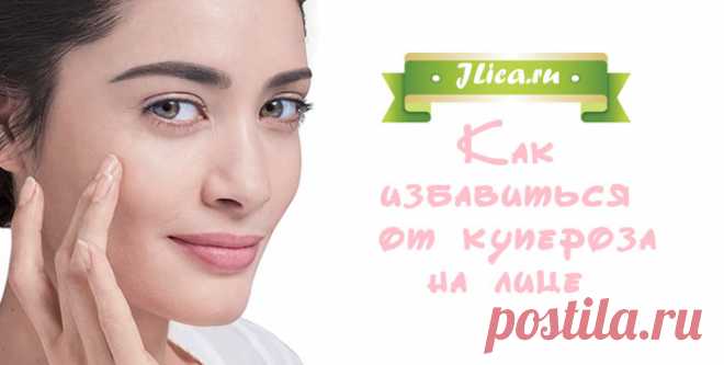 Купероз на лице: причины, способы лечения и отзывы