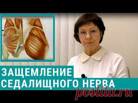 Защемление седалищного нерва: симптомы и лечение ущемления седалищного нерва