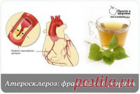 Атеросклероз и стенокардия. Фракийский рецепт = Следует нарвать  лесу верхушки крапивных кустиков. Их потребуется 500 г  обширный пакет. 
 
Листья только рвать, надев на руку перчатку или полиэтиленовый пакет. Дома листики хорошо размять деревянной лопаткой, но не резать ножом. 
 
Эти размятые листья залить литром 60-гр-ой водки, и в темной банке настаивать один день на свету, затем 8 дней в темном шкафу. Затем настой процедить и отжать. Принимать по 1 ч. л. за полчаса до еды 3-4 раза в день