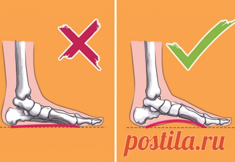Борьба с плоскостопием: техники немецких физиотерапевтов