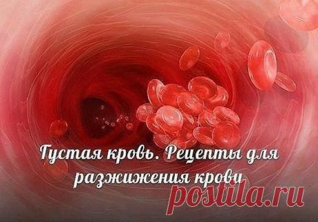 Продукты, помогающие разжижению крови

1. Помидоры препятствуют образованию тромбов в сердечно-сосудистой системе. Оказалось, что помидоры (как и аспирин) способствуют разжижению крови и к тому же (в отличие от аспирина) не дают побочных эффектов.

2. Грибы разжижают кровь, снижают уровень холестерина.

3. Разжижению крови помогают также ягоды клюквы, калины, облепихи. Чеснок обладает способностью разжижать кровь. Артишок помогает понижению вязкости крови и холестерина. В ...