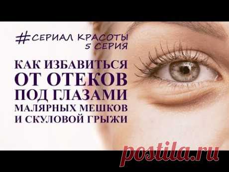 как убрать отеки под глазами, грыжи и  малярные мешки. омоложение глаз