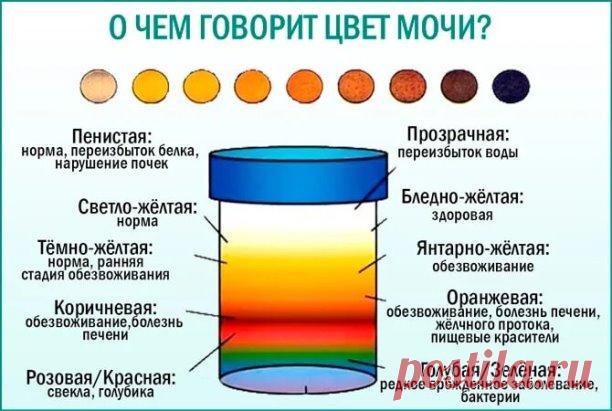 Тело человека, 
Цвет мочи и заболевания

Привыкли, что моча всегда желтая? Действительно, нормальный цвет — соломенно-желтый. Но она бывает и светлая, как вода, и бурая, и темно-коричневая, и красная. Окраска, а точнее, ее отклонение от нормы указывает на проблемы в мочевыводящих путях и почках.

Коричневый, ореховый цвет намекает на заболевание печени и избыток в моче желчных пигментов (билирубина), бурый — на воспаление мочевого пузыря (цистит), особенно если имеется бол...