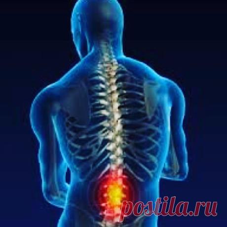 Лечение межпозвоночной грыжи народными методами