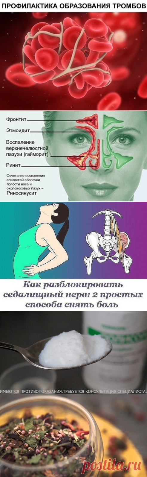 (49) Одноклассники