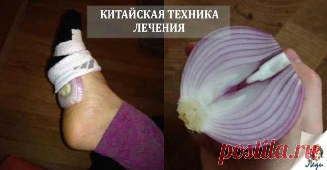На ночь положите лук в носки, и удивитесь, что произойдет с вашим организмом В китайской традиционной медицине есть понятие “меридианов”, которые подразумевают под собой каналы, по которым в теле циркулирует энергия ци. В иглоукалывании как раз и стимулируются эти самые мериди…