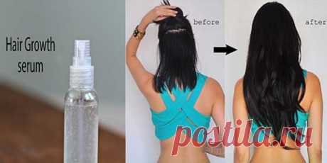 IT is not a joke! This natural hair growth serum can grow 4 inches hair every month Hair-serums purchased from stores are undoubtedly chemical laden cosmetics and also expensive. Today I am telling you about this herbal serum, which is getting very popular among ladies. Use of this serum will make your hair lengthy and strong. Here’s what you’ll need: 2 teabags – Chamomile tea 1/2 tbs – Dry Rosemary leaves 5 …