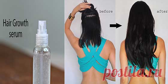 IT is not a joke! This natural hair growth serum can grow 4 inches hair every month Hair-serums purchased from stores are undoubtedly chemical laden cosmetics and also expensive. Today I am telling you about this herbal serum, which is getting very popular among ladies. Use of this serum will make your hair lengthy and strong. Here’s what you’ll need: 2 teabags – Chamomile tea 1/2 tbs – Dry Rosemary leaves 5 …
