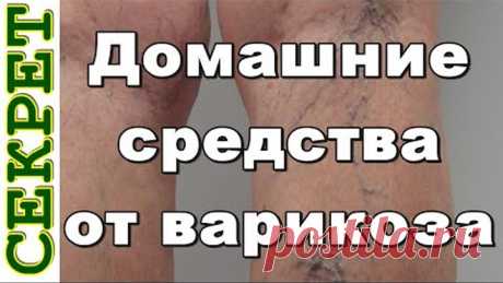 Народные средства от варикозного расширения вен