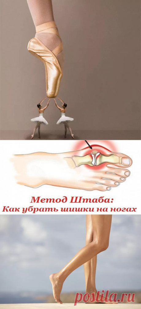 Как убрать шишки на ногах? Метод Штаба | Всегда в форме!