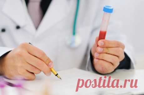 Анализ крови: подготовка к забору, как сдавать анализы крови