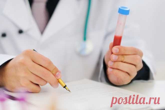 Анализ крови: подготовка к забору, как сдавать анализы крови