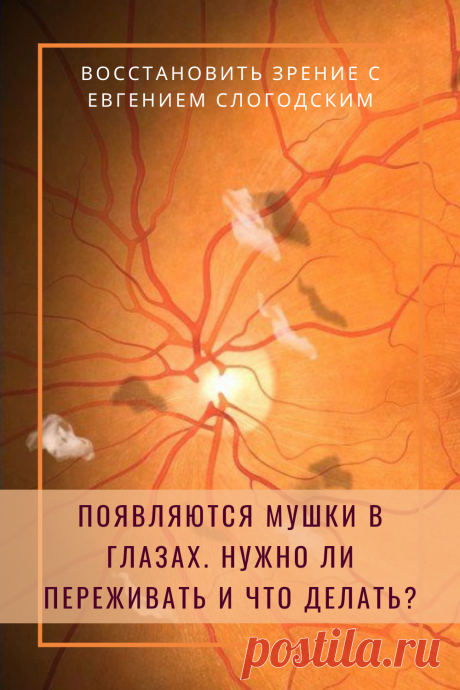 Мушки в глазах что это такое Зуд сухость глаз Деструкция стекловидного тела Как избавиться от плавающих мушек Нарушение зрения Вернуть зрение Помутнения перед глазами причины и лечение Средства для улучшения зрения Упражнения для глаз Мушки в глазах исчезают навсегда Плавающие помутнения точки паутинки перед глазами Болезни глаз Возрастное изменение Заболевания сетчатки Устают глаза Боль Плохое зрение Восстановить зрение с Евгением Слогодским без операции Гимнастика тренажёр для глаз Миодезопсия