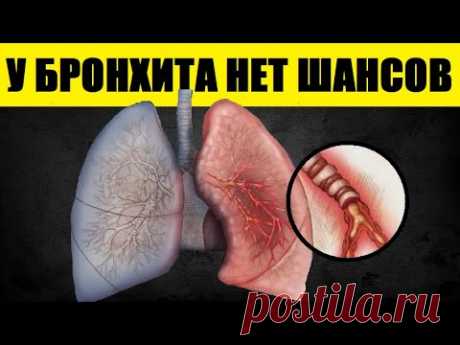 Даже Застарелый Хронический Бронхит Пройдёт! Возьмите 3 Луковицы Среднего Размера и Поместите в... - YouTube Просматривайте этот и другие пины на доске Рецепты из лука пользователя Ольга.
Теги
Даже Застарелый Хронический Бронхит Пройдет! Возьмите 3 Луковицы Среднего Размера и Поместите на 12 Часов в...
- YouTube
Даже застарелый хронический бронхит пройдёт если взять 3 луковицы среднего размера запечь в духовке, а потом их потереть на тёрке.
Получается очень вкусная, сладкая луковая каша!