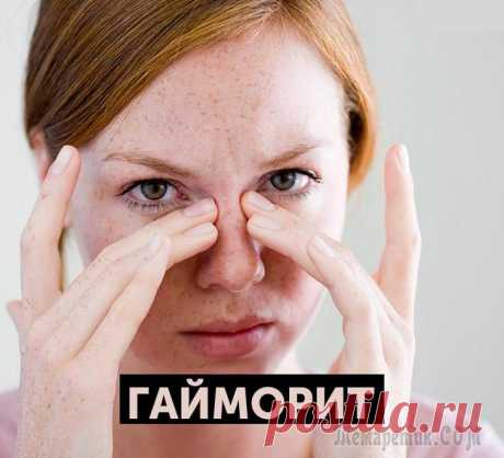 Гайморит: эффективное лечение народными средствами Эффективное лечение гайморита народными средствами подтверждают многочисленные самые положительные отзывы выздоровевших людей.
Гайморит зачастую возникает на фоне затяжной простуды или гриппа. Заболев...