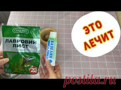ЛАВРОВЫЙ  лист и  ВАЗЕЛИН.   МОЩНОЕ лекарство  бабушки 85 лет  ! - YouTube