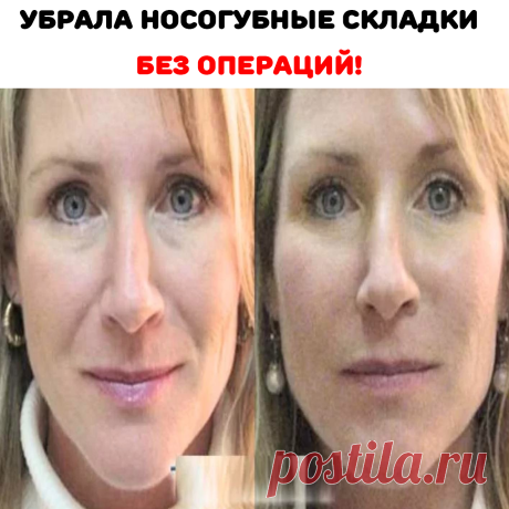 Рецепт: спирулина — 4 таблетки
желатин — 2 ч.л.
сок лимона — 0,5 ч.л.
витамин А — 2 капли

Заливаем желатин ¼ стакана теплой кипяченой воды и даем набухнуть в течение получаса, затем подогреваем слегка на водяной бане.

Таблетки Спирулина (микроводоросль ) заливаем 2 ст .ложками воды, разминаем и вливаем лимонный сок и витамин А жидкий.

Соединяем с желатином, хорошо размешиваем и наносим на носогубные складочки. Через 15 минут смываем водой.Избегайте область вокруг глаз.