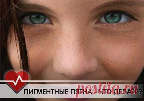 Пигментные пятна - что делать!

Если у вас на руках и лице появляются пигментные пятна, они исчезнут после курса лечения специальной мазью, сделанной по очень простому рецепту.

Понадобится:
Касторовое масло, сода, бактерицидный лейкопластырь.

* Смешать касторовое масло и пищевую соду (на 1 ст. ложку масла - соды на кончике ножа).
* Нанести на пигментное пятно на ночь.
* Сверху заклеить лейкопластырем.
* Применять пока пятно не исчезнет.

Кожа со временем станет светлее и...