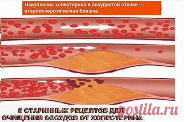 Всё самое интересное!: Хвойный настой с шиповником для очищения сосудов!
