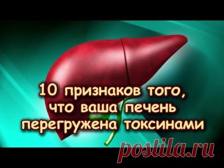 10 ПРИЗНАКОВ того, что ПЕЧЕНЬ ПЕРЕГРУЖЕНА ТОКСИНАМИ - YouTube